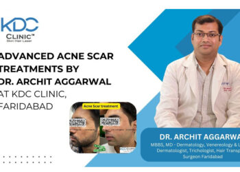 Advanced Acne Scar Treatments by Dr. Archit Aggarwal at KDC Clinic, Faridabad