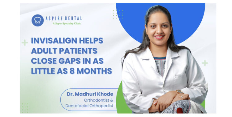 Invisalign Treatment Delivers Predictable Results for Adult Patients, Achieving Complete Space Closure in as Little as 8 Months