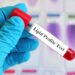 Why Regular Lipid Profile Tests Are Crucial for Heart Health